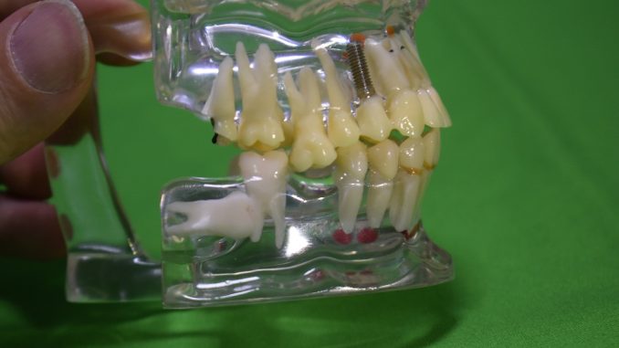 Gömük 20 yaş dişi